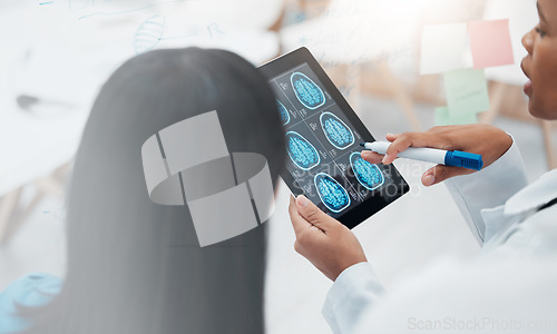 Image of Doctors, tablet screen and neurology mockup team talking healthcare and brain analysis. Medical expert women hands with technology for mri assessment, research and innovation for health therapy plan