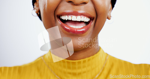 Image of Teeth, smile and closeup of black woman with beauty, lips or happiness in studio white background. Mouth, dental care or African model laugh with skincare, dermatology or wellness from healthcare