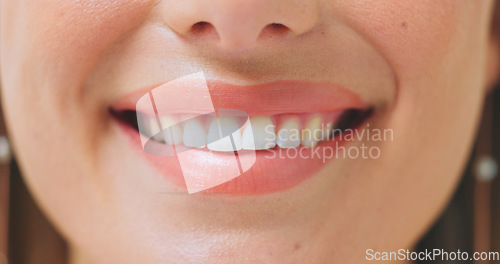 Image of Dental, zoom and woman smile with teeth whitening, results or oral hygiene treatment. Mouth, closeup and female person happy with breath, tooth or gum cleaning, veneers or orthodontics satisfaction