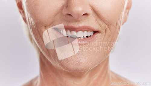 Image of Happy woman with teeth and smile, showing her natural looking dental veneers posing against a purple mockup studio background. Model woman happy with her oral healthcare hygiene and health skincare