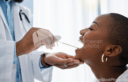 Image of Doctor, otolaryngologist or dentist with a medical instrument checking the throat for tonsils or oral cancer. Health, healthcare worker and wellness with an ent specialist examining a black woman