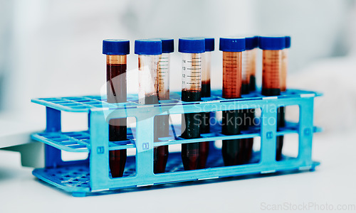 Image of Closeup blood, test tube or medical research in science laborary for testing, checking or examining DNA sample. Searching for breakthrough cure for marburg virus, monkeypox or global pandemic disease