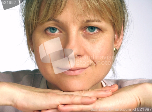 Image of Correction of wrinkles on half of face