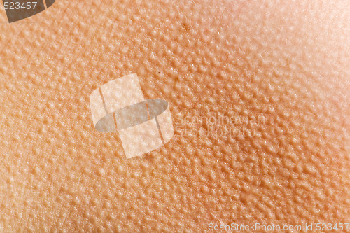 Image of Goosebumps Skin Background