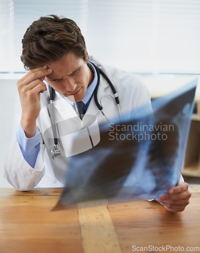 Image of Doctor, man and check xray, headache and stress in healthcare, medical diagnosis and review of lung scan at cardiology clinic. Radiology, assessment of MRI results and bad news with surgeon