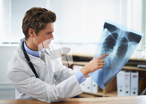 Image of Man doctor in office, analysis of xray and health, medical diagnosis and review of lung scan at cardiology clinic. Radiology, assessment of results and human anatomy with surgeon, MRI and skeleton
