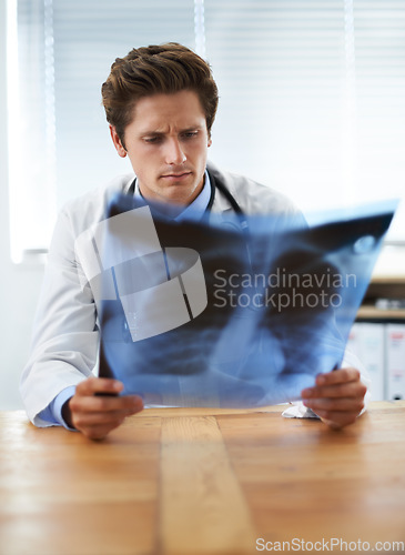 Image of Man doctor in office and check xray, healthcare with medical diagnosis and review of lung scan at cardiology clinic. Radiology, surgeon thinking in doubt after assessment of results with MRI