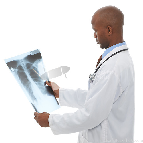 Image of Doctor, black man or check xray scan for lung cancer evaluation, clinic research or medical investigation. Studio MRI, radiology or African surgeon with anatomy assessment results on white background