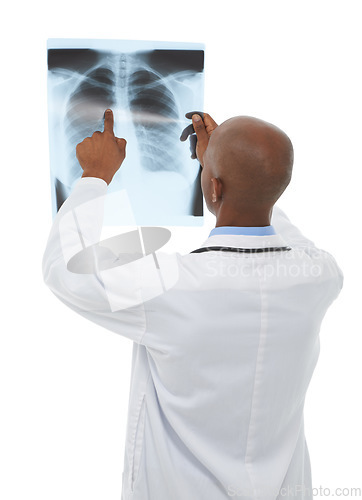 Image of Doctor, xray scan and person review MRI results for lung evaluation, clinic test or medical exam. Studio, health support and back of radiologist problem solving anatomy assessment on white background