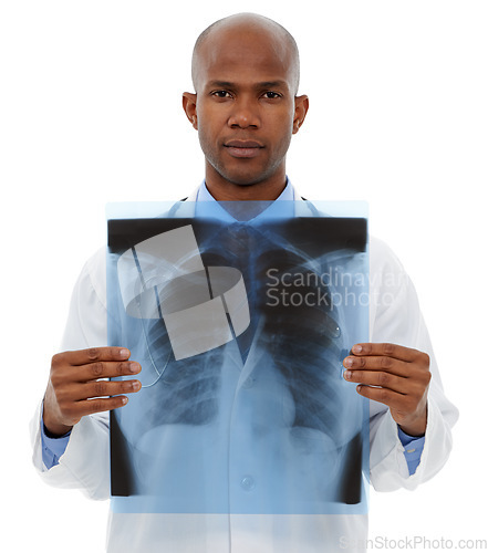 Image of Portrait, man and doctor with x ray, healthcare and employee isolated on white studio background. Face, support and African person with scans, test results or disease with radiologist or mockup space