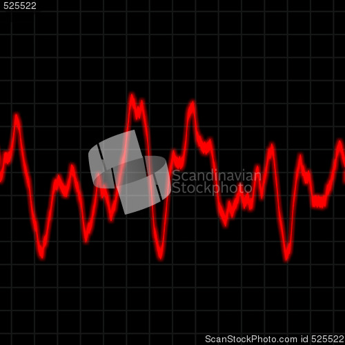 Image of Heart Rate Monitor