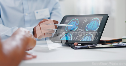 Image of Doctor, hands and tablet with brain scan for patient, consultation or examination results at hospital. Closeup of person, medical employee or nurse pointing to technology for MRI at neurology clinic