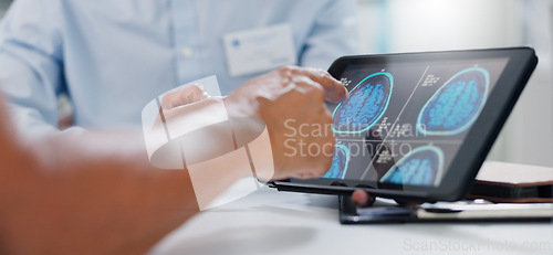 Image of Doctor, hands and tablet with brain scan for patient, consultation or examination results at hospital. Closeup of person, medical employee or nurse pointing to technology for MRI at neurology clinic