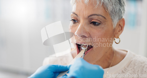 Image of Patient, doctor and tongue depressor for throat assessment in clinic for respiratory infection, inflammation or wellness. Elderly woman, man and mirror for healthcare consultation, diagnosis or exam