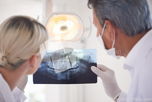 Image of Dental, care and team checking x ray with man, woman and professional opinion for consultation from back. Dentist, technician and healthcare of mouth for gums, teeth and expert advice on toothache.