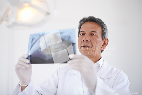 Image of Mature dentist, man and xray of teeth for dental surgery, healthcare and oral health with treatment at clinic. Medical professional with analysis of scan, review and orthodontics with mouth care