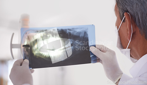 Image of Dentist, man and xray closeup of teeth for dental surgery, healthcare and oral health at clinic. Medical professional with analysis of scan, radiology and orthodontics for mouth care with treatment