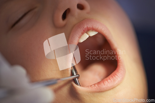 Image of Closeup, child and dentist with mirror in mouth for gum disease and oral hygiene with dental inspection. Medical, orthodontics and consultation for teeth health, cleaning and wellness with instrument