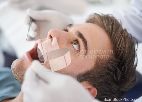 Image of Dental, man and dentist with tools for healthcare, gum disease and oral hygiene with mouth inspection. Medical, orthodontics and consultation for teeth health, cleaning and wellness with excavator