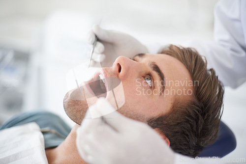 Image of Man, hands and dentist with tools for healthcare, gum disease and oral hygiene with mouth inspection. Medical, orthodontics and consultation for teeth health, cleaning and wellness with excavator