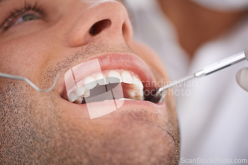 Image of Closeup, man and dentist with tools in mouth for gum disease and oral hygiene with dental inspection. Medical, orthodontics and consultation for teeth health, cleaning and wellness with instrument