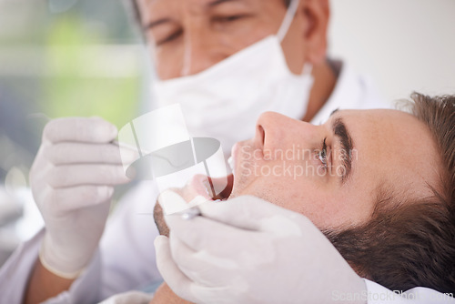 Image of Dental, man and dentist with tools for healthcare, gum disease and oral hygiene with mouth inspection. Medical, orthodontics and consultation for teeth health, cleaning and wellness with excavator