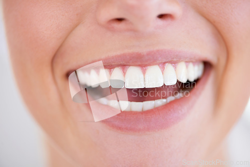 Image of Smile, dental and closeup of woman teeth with health, wellness and morning oral hygiene routine. Self care, happy and zoom of young female person with mouth for clean, fresh or dentistry treatment.