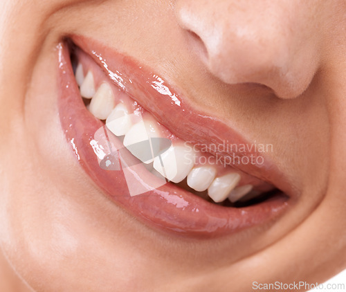 Image of Closeup, studio and mouth of woman for teeth whitening and happy for cosmetic dental hygiene or orthodontics. Model, smile and grooming with dentist results, implant and invisible braces or veneers