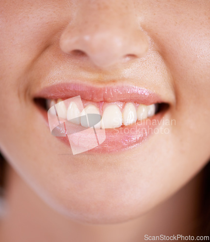 Image of Dental, mouth and teeth with smile of woman closeup at dentist for oral hygiene appointment. Cleaning, tooth or whitening with happy person at orthodontist for checkup to prevent gum disease