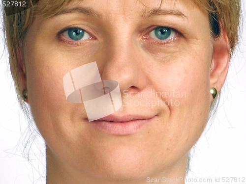 Image of Correction of wrinkles - half of face