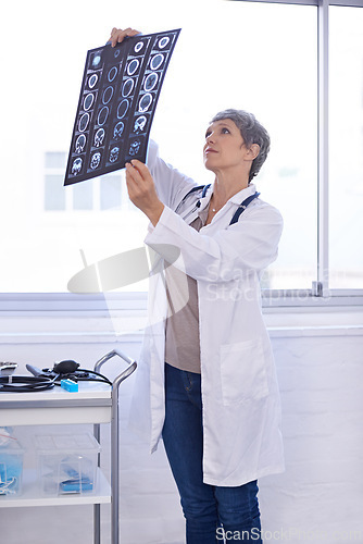 Image of Woman, senior doctor and study xray for planning medical treatment, surgery and healthcare at hospital. Brain scan, neurology and radiology with surgeon for health assessment, anatomy and MRI