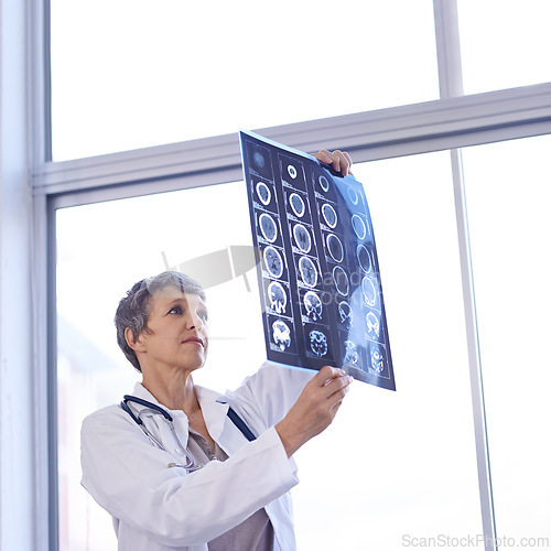 Image of Woman, mature doctor and study xray for planning medical treatment, surgery and healthcare at hospital. Brain scan, neurology and radiology with surgeon for health assessment, anatomy and MRI