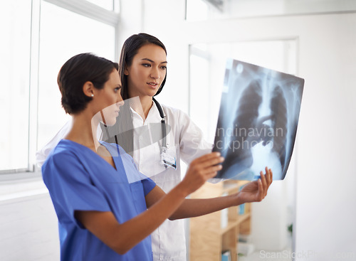 Image of X ray, doctor and nurse with results in hospital, medical facility or clinic for lung exam or radiology. Women, people and healthcare workers with document, research or analysis of respiratory system