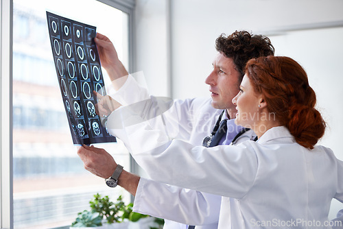 Image of Doctors, brain scan and reading for results at hospital with pointing, teamwork and health by window. Neurologist, partner and medic with mri for wellness, check and decision with document in clinic