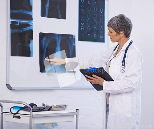 Image of Senior doctor, woman and medical xray with clipboard for checklist, assessment and radiology for surgery. Lungs, cardiology and anatomy scan for healthcare with surgeon at treatment plan at clinic