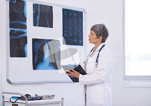 Image of Senior doctor, woman and study xray with clipboard for checklist, assessment and radiology for surgery. Lungs, brain and bones with anatomy scan for healthcare, surgeon and treatment plan at clinic