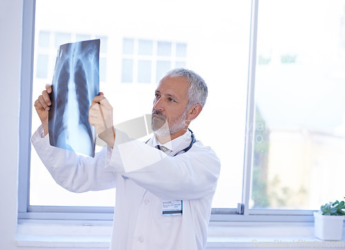 Image of Hospital, thinking and doctor with x ray for research, medical service or surgery review. Healthcare, radiology clinic and senior health worker with anatomy scan for analysis, diagnosis or consulting