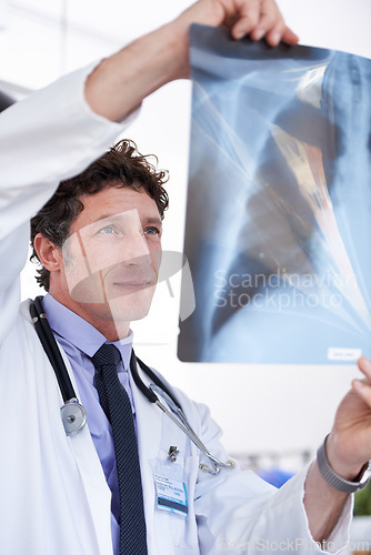 Image of Doctor, man and xray in hospital for reading results with thinking for lungs, decision or healthcare. Professional medic, check and film paper for respiratory system exam for asthma with radiology