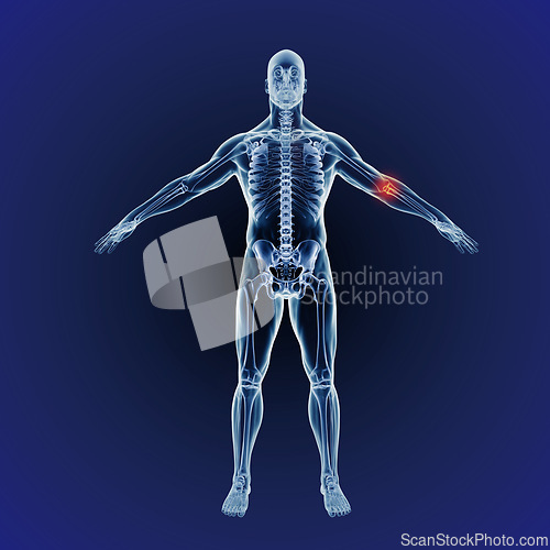 Image of Body, skeleton and red pain in arm with graphic for xray, exam or analysis in medical overlay. 3D anatomy, radiology and elbow for illustration of injury or physiotherapy on a dark or blue background