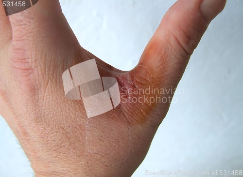 Image of injured