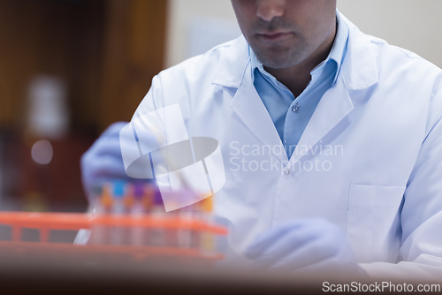 Image of Young medical technician in lab coat preparing blood samples for testing in clinical laboratory