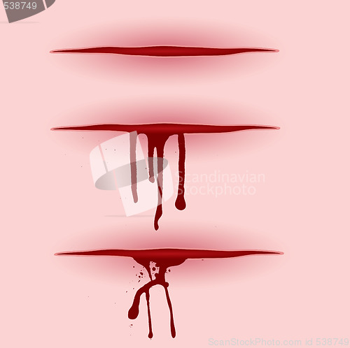 Image of blood cut