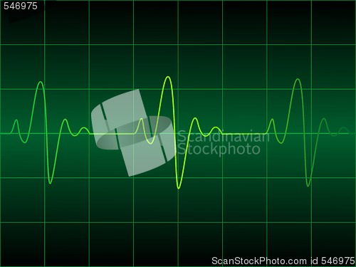 Image of Heart cardiogram 