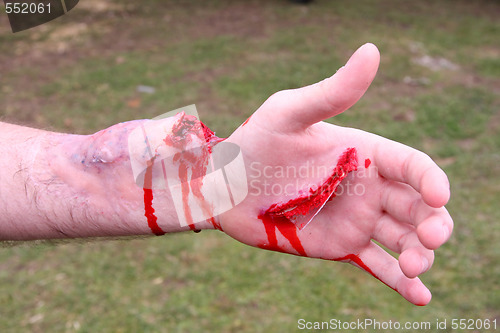 Image of hand with blood