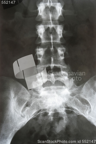 Image of X-ray