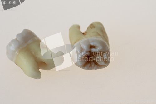 Image of third molars