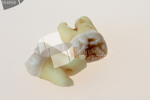 Image of third molars