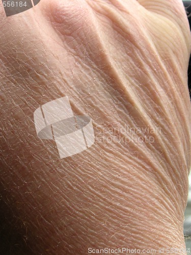 Image of aging skin