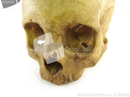 Image of skull close-up