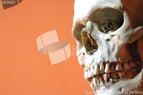 Image of Human skull